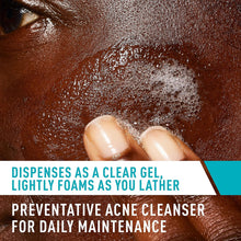 Load image into Gallery viewer, Acne Control Cleanser