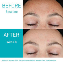 Load image into Gallery viewer, Resurfacing Retinol Serum
